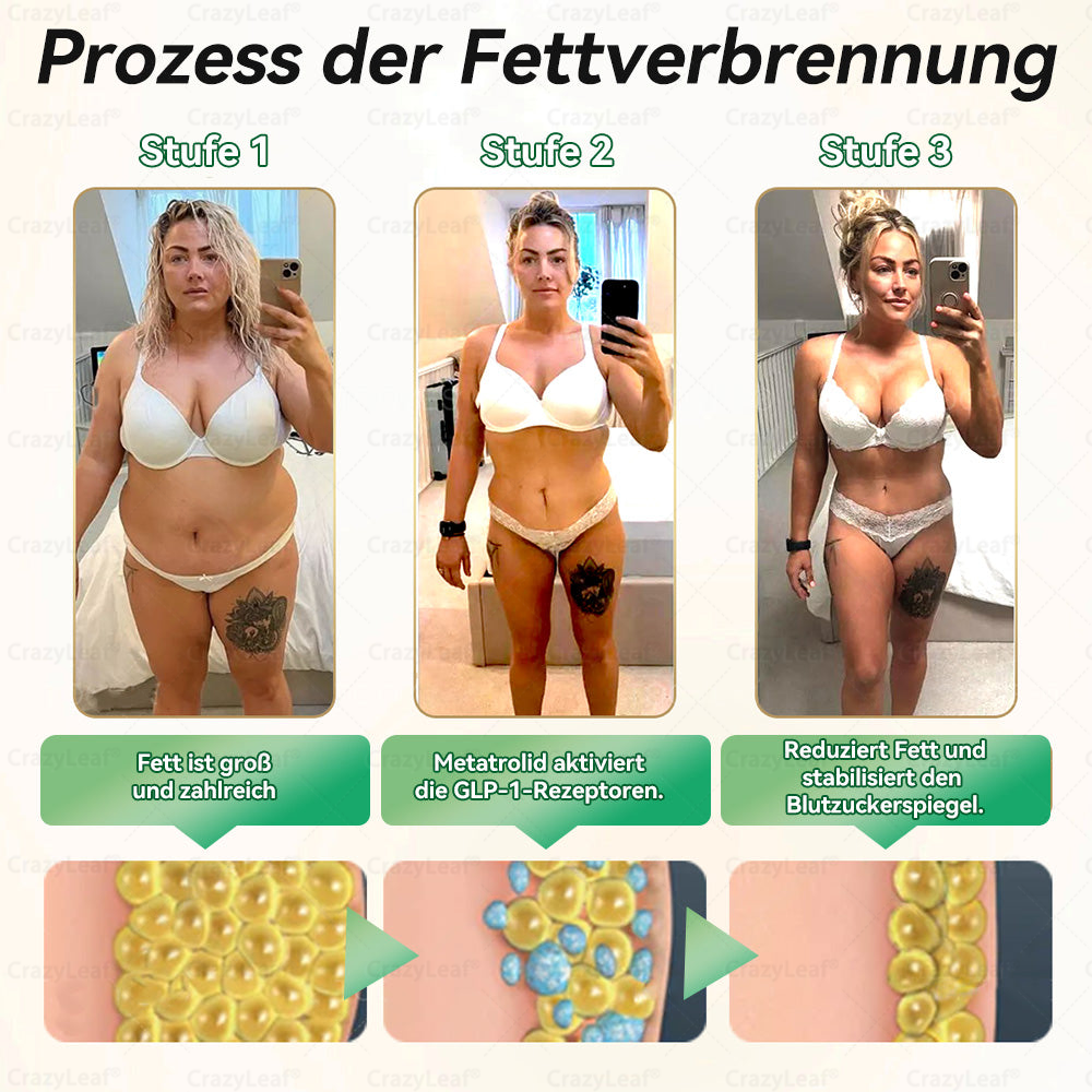 CrazyLeaf® GLP-1 Lösung zum Einnehmen 🍀 Nur 1x pro Woche, erste Veränderungen in 7 Tagen sichtbar ✅ Für Adipositas, Herz-Kreislauf, Diabetes, Schlafapnoe, Gelenke und mehr 🍀