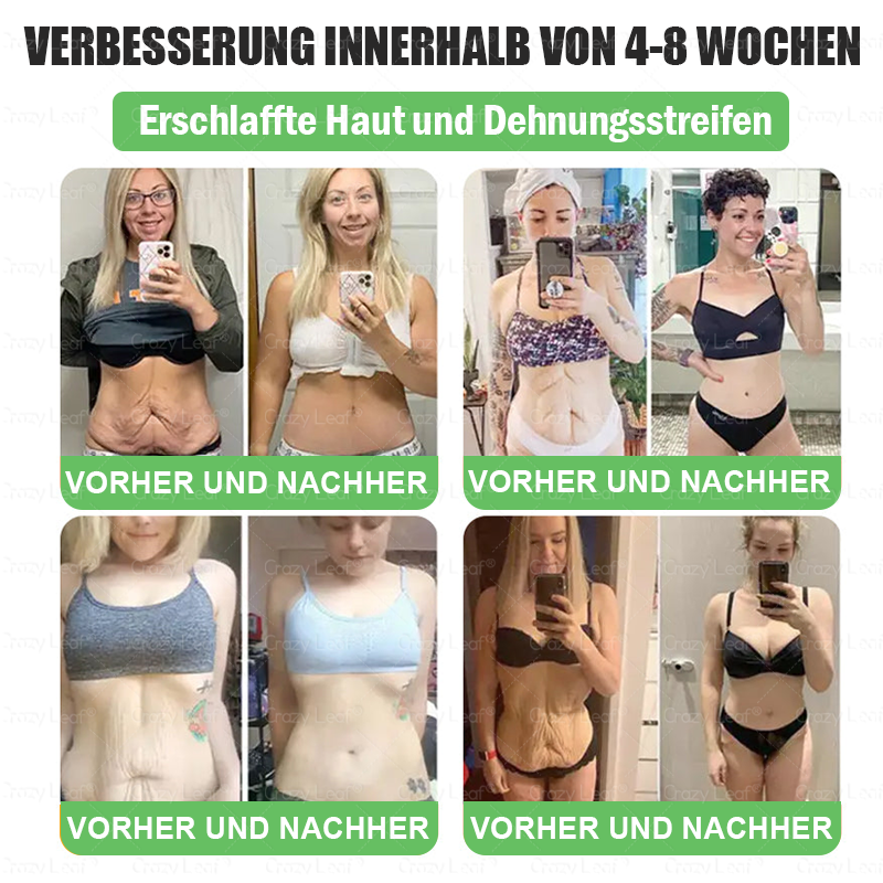 Nur noch 5 Packungen CrazyLeaf® übrig! 🎉 Wir bieten extra 50% Rabatt! Hol dir deinen Traumkörper – jetzt oder nächstes Jahr! ✨