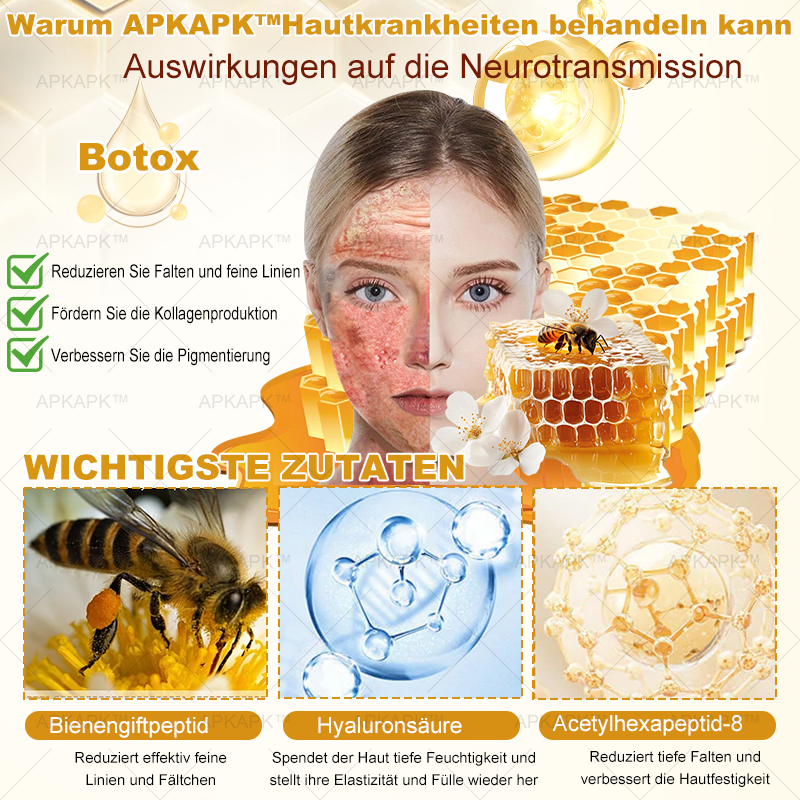 Hergestellt in Deutschland ✨AРKAРК™ Bienengift Umfassende Creme – Anti-Aging, Feuchtigkeitsspendend, Hautreparatur, Hautbildverbesserung, Akne- und Pigmentfleckenbehandlung, Warzen- und Muttermalentfernung, Linderung bei Psoriasis