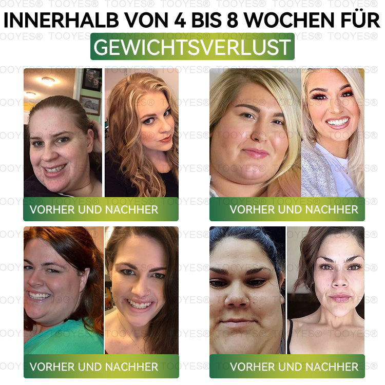 TOOYESÂź Letzte Chance! đ Sichern Sie sich dieses GlĂŒcksangebot mit 70 % Rabatt! đ