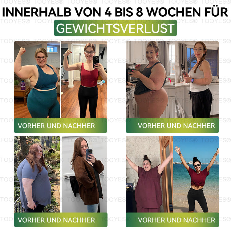 TOOYESÂź Letzte Chance! đ Sichern Sie sich dieses GlĂŒcksangebot mit 70 % Rabatt! đ