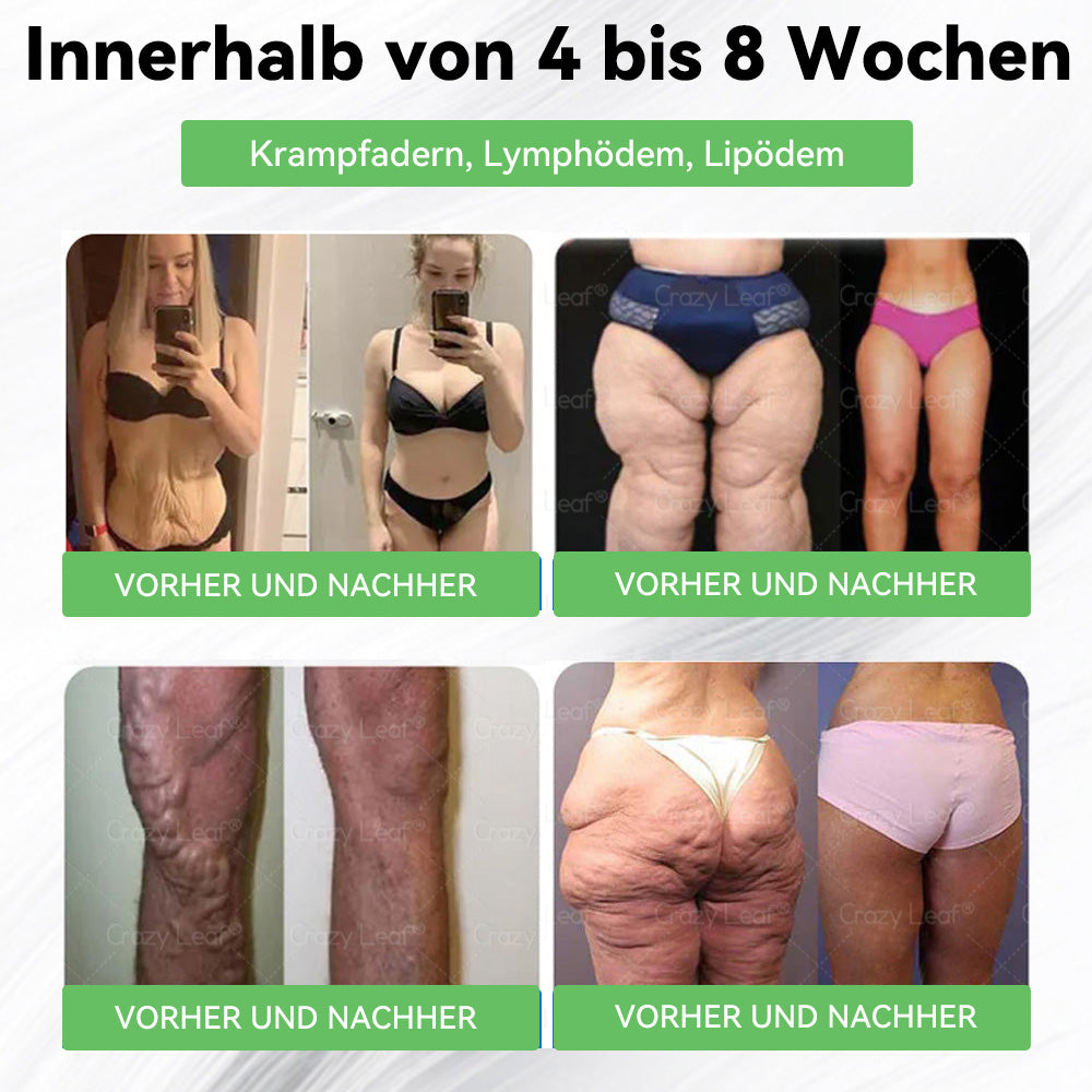 Nur noch 5 Packungen CrazyLeaf® übrig! 🎉 Wir bieten extra 50% Rabatt! Hol dir deinen Traumkörper – jetzt oder nächstes Jahr! ✨
