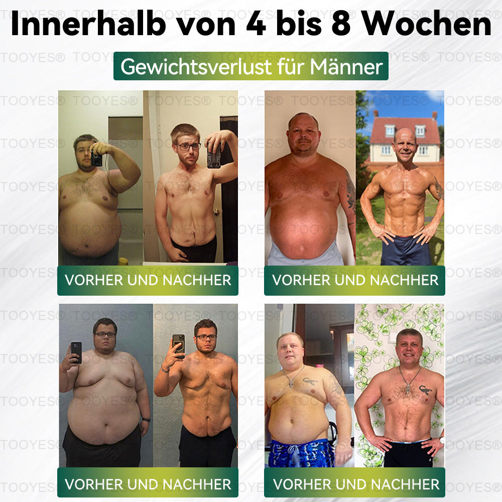 TOOYESÂź Letzte Chance! đ Sichern Sie sich dieses GlĂŒcksangebot mit 70 % Rabatt! đ
