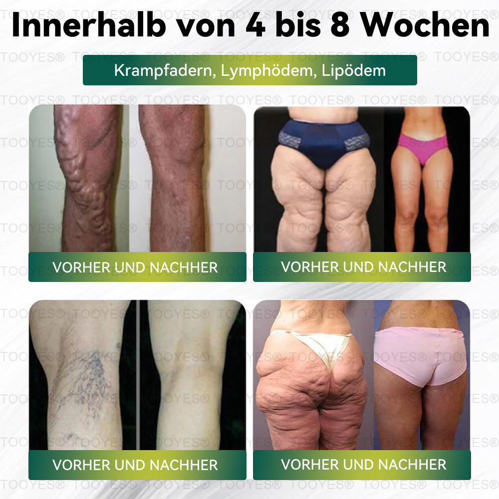 TOOYESÂź Letzte Chance! đ Sichern Sie sich dieses GlĂŒcksangebot mit 70 % Rabatt! đ