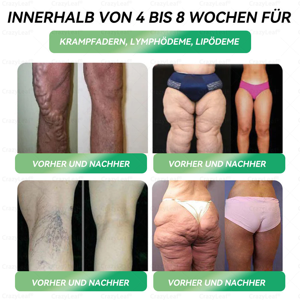 CrazyLeaf® GLP-1 Lösung zum Einnehmen 🍀 Nur 1x pro Woche, erste Veränderungen in 7 Tagen sichtbar ✅ Für Adipositas, Herz-Kreislauf, Diabetes, Schlafapnoe, Gelenke und mehr 🍀