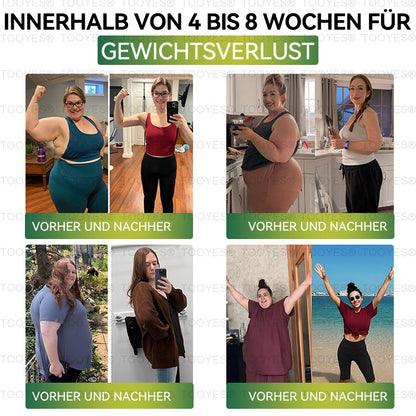 TOOYES® Letzte Chance! 🎉 Sichern Sie sich dieses Glücksangebot mit 70 % Rabatt! 🍀