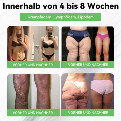 Nur noch 5 Packungen CrazyLeaf® übrig! 🎉 Wir bieten extra 50% Rabatt! Hol dir deinen Traumkörper – jetzt oder nächstes Jahr! ✨